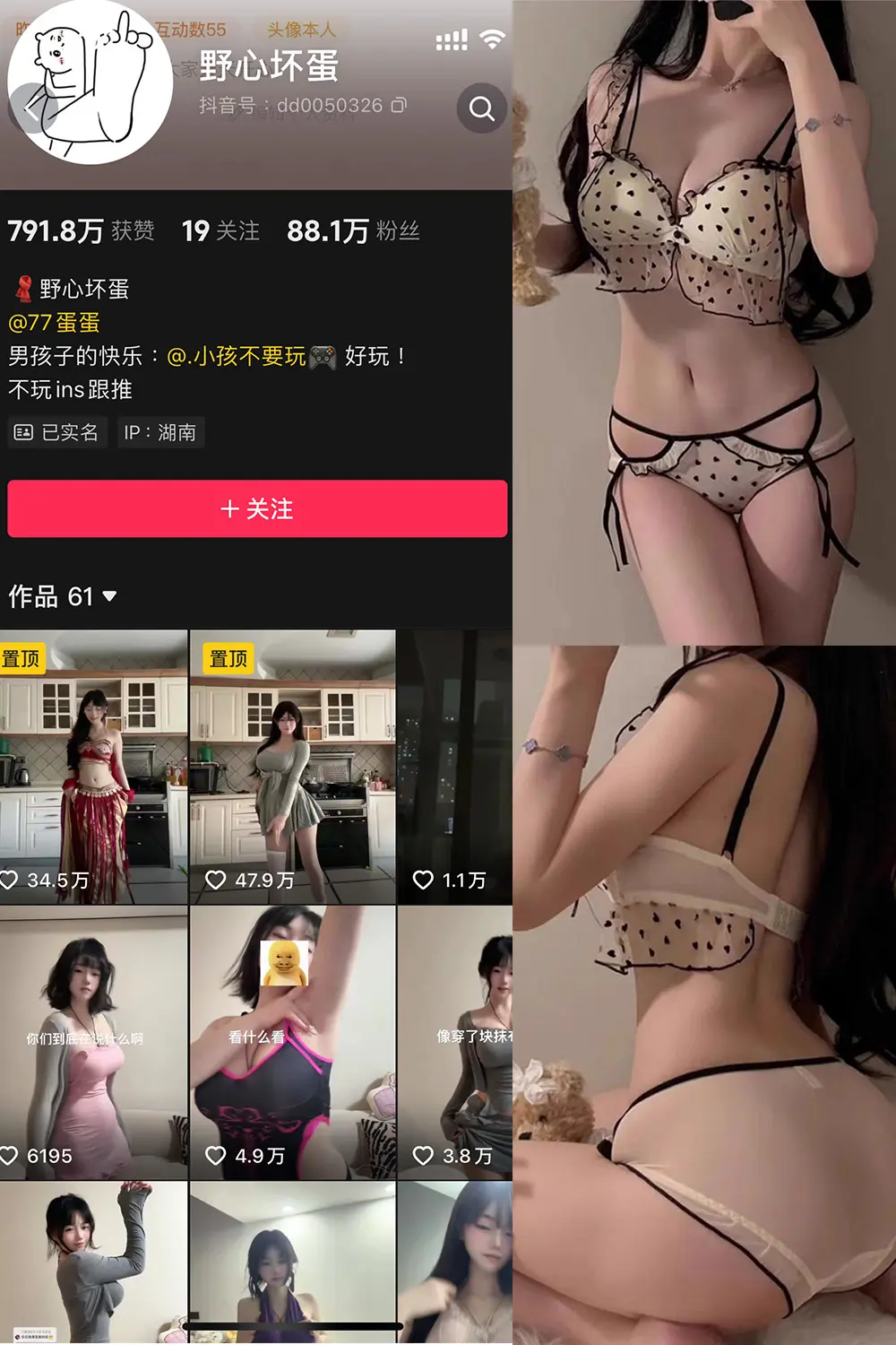 抖音 野心坏蛋 微密圈 NO.007期 【13P】最新至：2025.1.12-美美写真